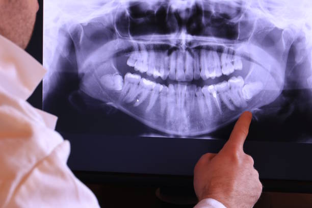 Best Emergency Broken Tooth Repair in Manassas, VA