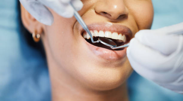 Best Emergency Wisdom Teeth Removal in Manassas, VA